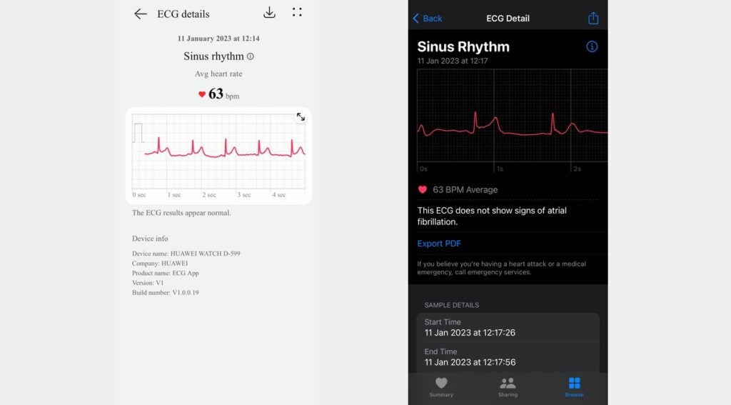 7081 smartwatches wearable tech news the new huawei watch d told us we had high blood pressure image7 jovb0xljph.jpg