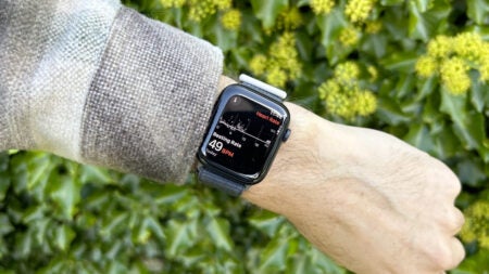 Apple Watch and AI used in Stanford study to help identify CRPS triggers in children