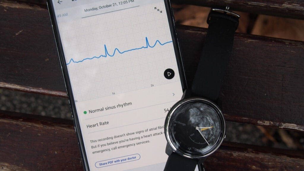 Withings Move ECG review