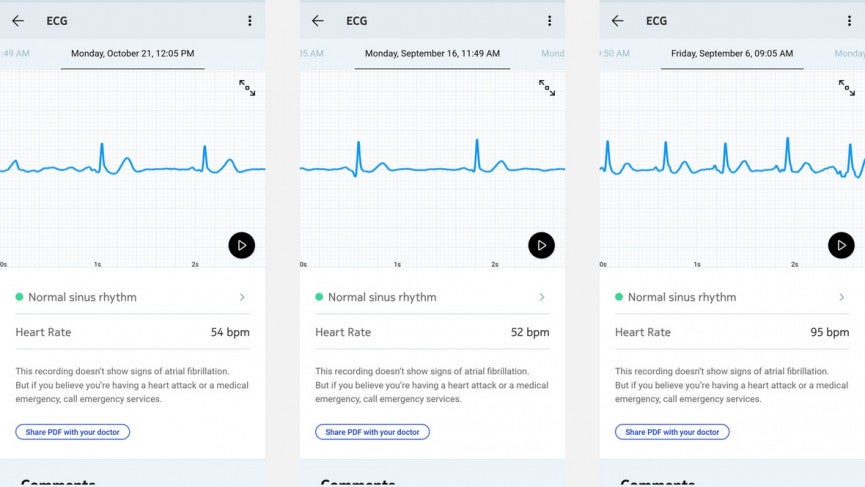 Withings Move ECG review